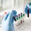 Global Tech Roundup: Medical Researchers Trying to Generate Human Kidneys in Livestock Make Huge Breakthrough