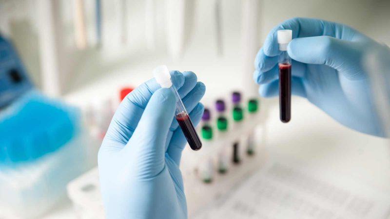 Global Tech Roundup: Medical Researchers Trying to Generate Human Kidneys in Livestock Make Huge Breakthrough