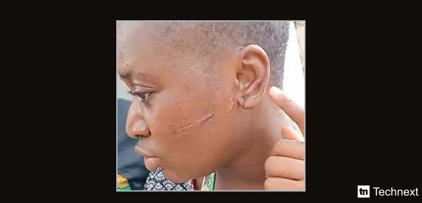 Alledged Lagos robery and stabbing: inDrive says victim did not book ride on app